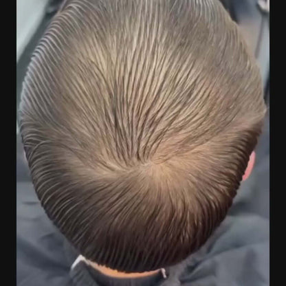 Haarcamouflage